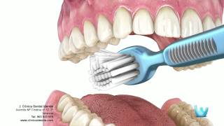 Higiene dental  Clinica identis [upl. by Nesahc]