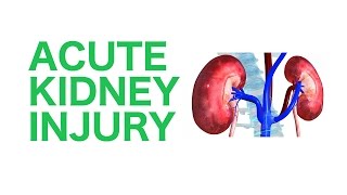 Acute Kidney Injury AKI  USMLE [upl. by Wise]