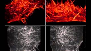 Narrated Filopodia Waving on the Surface of a HeLa Cell [upl. by Vasily259]