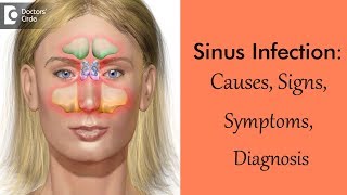 What are the symptoms of sinusitis [upl. by Brigitte]