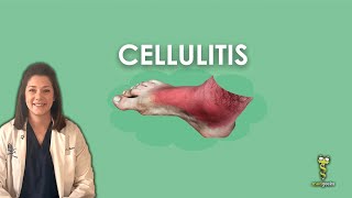 Cellulitis [upl. by Elinore463]