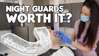 Are Night Guards REALLY Worth It [upl. by Glennie229]