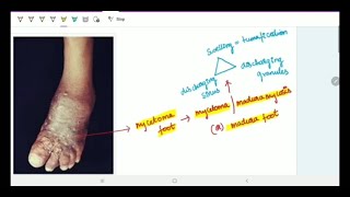 Overview of Fungal Skin Infections  Tinea Infections [upl. by Loreen541]