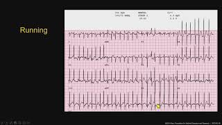 Technology SeriesMedicalStress Testing Pearls [upl. by Annawaj]