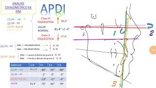 Cefalometria de kim  apdi [upl. by Graner]