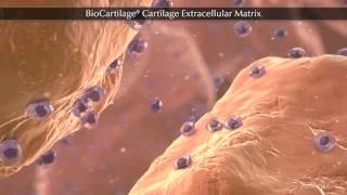 BioCartilage® Cartilage Extracellular Matrix [upl. by Rorie499]