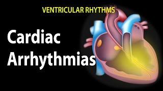 Cardiac Arrhythmias Animation [upl. by Tavie245]