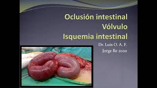 OBSTRUCCION INTESTINAL [upl. by Hunfredo]