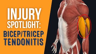 Injury Spotlight Bicep amp Tricep Tendonitis [upl. by Terrej]