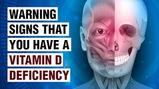 14 Signs Of Vitamin D Deficiency [upl. by Flyn918]