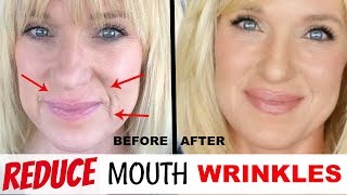 Get RID Of MOUTH WRINKLES WithOUT Fillers [upl. by Richardson]