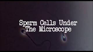 What Are Sperm Cells Sperm Under The Microscope [upl. by Haramat]