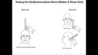 Interpreting the WeberRinne Tests EXPLAINED [upl. by Jamaal]