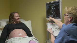 Ultrasounds during pregnancy [upl. by Kraul]