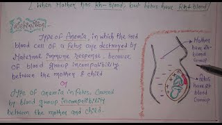 RHINCOMPATIBILITY ERYTHROBLASTOSIS FETALIS [upl. by Tobit560]