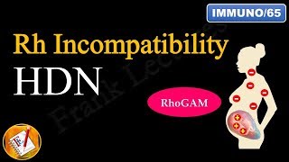 Rh Incompatibility Hemolytic Disease of the Newborn Erythroblastosis fetalis FLImmuno65 [upl. by Faubion]