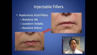 How Do I Get Rid of Smokers Lines  Lip Wrinkles Consultation  Dr Anthony Youn [upl. by Kylen]