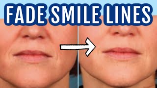 12 ways to fade smile lines nasolabial folds Dr Dray [upl. by Spike]