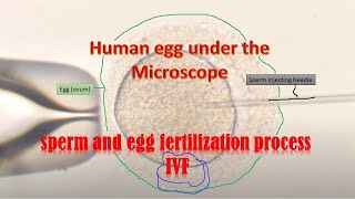 Human eggs under the Microscope during IVF fertilization [upl. by Almire274]