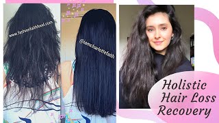 Dandruff treatment at Home with ALOE VERA  💯 Cure For Dandruff amp Hair Fall [upl. by Ahsenal4]