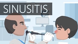 Managing Chronic Sinusitis [upl. by Enneiluj]