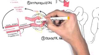 Chronic Kidney Disease CKD Pathophysiology [upl. by Ellehciram43]