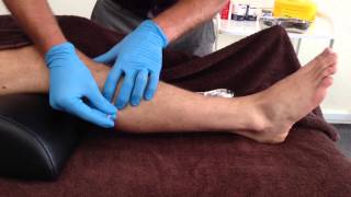 Dry Needling Peroneus Longus amp Brevis [upl. by Eppes619]