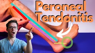 Peroneal Tendonitis Treatment 2024 Peroneus Brevis amp Longus Pain [upl. by Enoved]