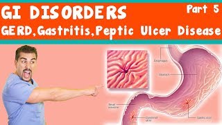 GI Disorders GERD Gastritis peptic ulcer Disease Part 5 [upl. by Drofiar]