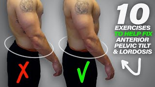 10 Exercises to Help Fix Anterior Pelvic Tilt amp Lordosis [upl. by Conlon307]