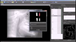 Blue Sky Plan Training Tutorial Ceph Functionality XRay and CT [upl. by Constantino]