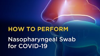 Nasopharyngeal Swab for COVID19 [upl. by Htieh]