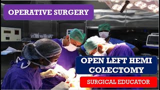 OPEN LEFT HEMICOLECTOMY STEP BY STEP Operative Surgery [upl. by Wolford]