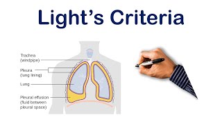 Pleural Effusion Lights Criteria  USMLE STEP COMLEX NCLEX [upl. by Leong642]