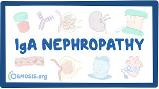 Chronic Kidney Disease Pathophysiology EASY  Full Nursing Lecture [upl. by Padraic]