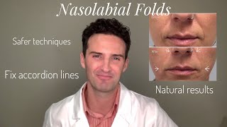 Nasolabial Folds amp Accordion Lines A Tutorial [upl. by Gallager]