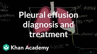 Pleural effusion diagnosis and treatment  Respiratory system diseases  NCLEXRN  Khan Academy [upl. by Nahguav16]