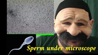 Sperm under microscope [upl. by Adnolohs]