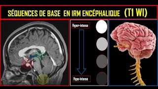 Séquences de base en IRM encéphalique Séquence T1 [upl. by Anehc]