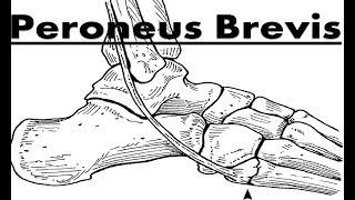 Peroneus Fibularis Brevis Tendinitis Pain Home Treatment Guide [upl. by Haramat]