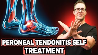 Peroneal Tendonitis Self Treatment Stretches Exercises amp Massage [upl. by Kellen]