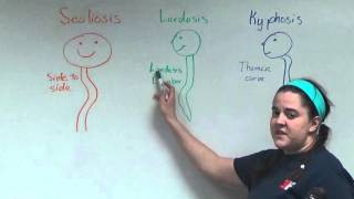 Scoliosis Lordosis and Kyphosis [upl. by Sul]