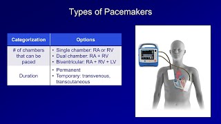 An Introduction to Pacemakers [upl. by Eerat107]