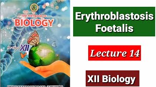 Erythroblastosis Foetalis Lecture 14 [upl. by Leasi782]