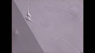 Sperm swimming in microscope field [upl. by Hadlee704]