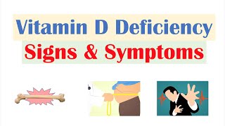 Vitamin D Deficiency Signs amp Symptoms ex Fatigue Diagnosis Treatment [upl. by Aiekahs]