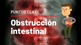 PUNTOS CLAVE de Obstrucción Intestinal [upl. by Nylrebma]