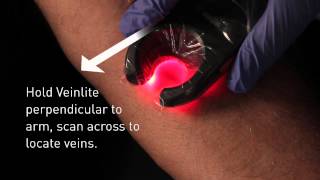 Veinlite LED Vein Finder Demo [upl. by Hniv]