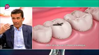 Clínica Dental Cuevas Queipo  quotPrevención Bucodental  Odontología Preventivaquot [upl. by Lekar]