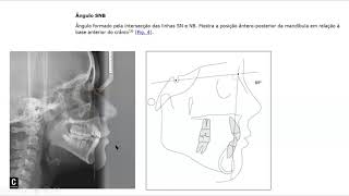 Aula de Cefalometria [upl. by Pettiford]